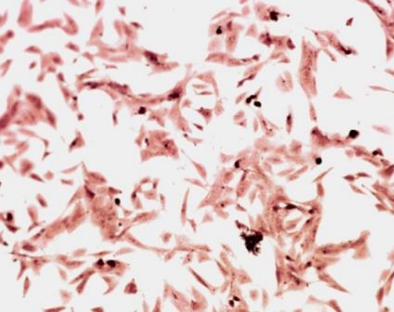 lactosporin