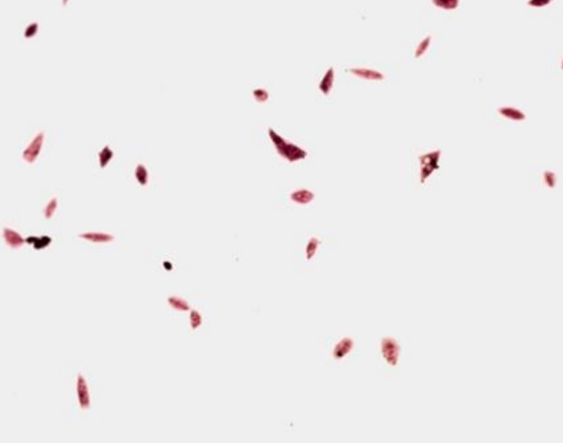 lactosporin